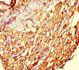 KMT5A Antibody
