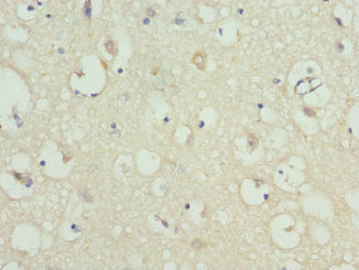 KCNIP2 Antibody