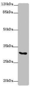 KCNIP2 Antibody