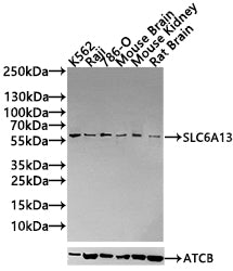 SLC6A13 Antibody