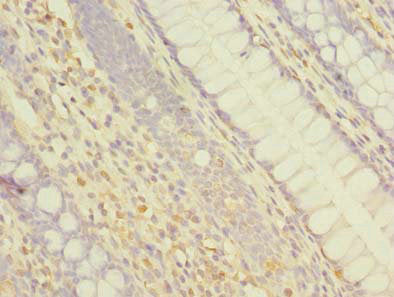 ABCF3 Antibody