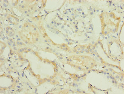 FBXO28 Antibody