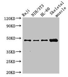 RBM22 Antibody