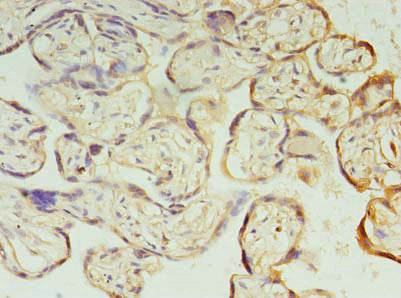 PIH1D1 Antibody