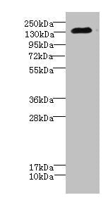 CACNA2D2 Antibody