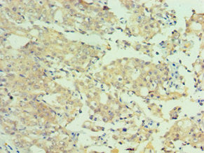 MTMR4 Antibody