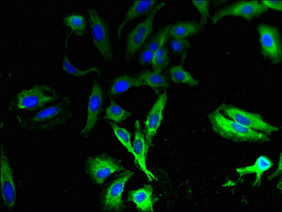 TAS2R13 Antibody
