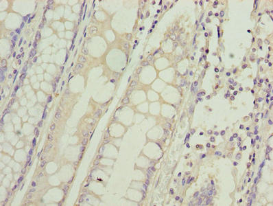 HIGD1B Antibody