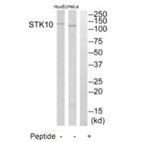 STK10 Antibody