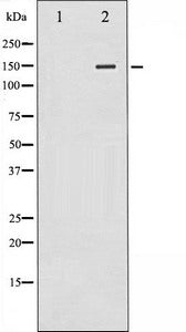 PLCG2 Antibody