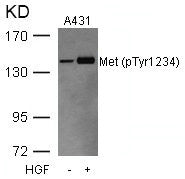 Phospho-MET (Tyr1234) Antibody