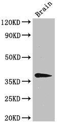 B4GALT7 Antibody
