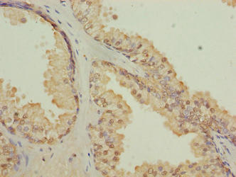 CGGBP1 Antibody