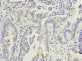 VANGL2 Antibody