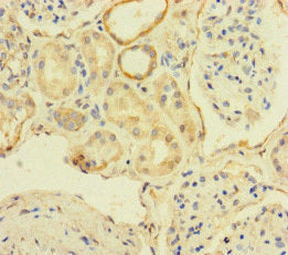 TBC1D24 Antibody