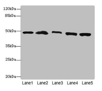 PSMD13 Antibody