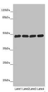 ST3GAL5 Antibody