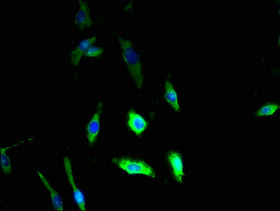 DSE Antibody