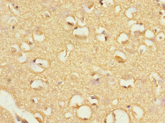 FBXO4 Antibody