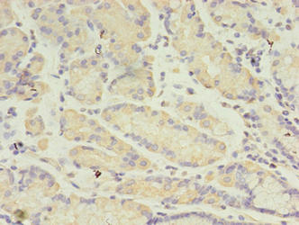 ANGPTL2 Antibody