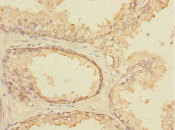 ELF5 Antibody