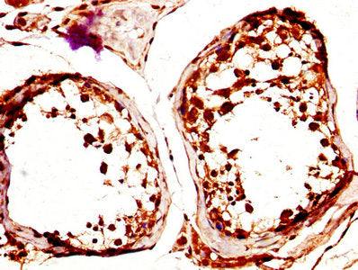 CLEC4E Antibody