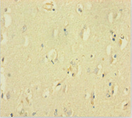 GABRQ Antibody
