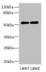 TRMT6 Antibody