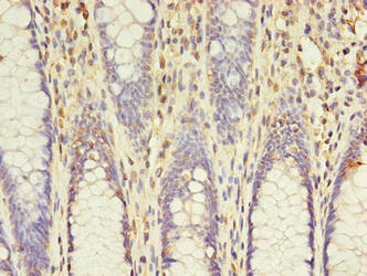 ACSL5 Antibody