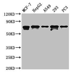 MAGED2 Antibody