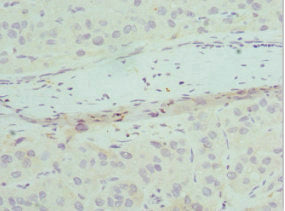 CHMP2B Antibody