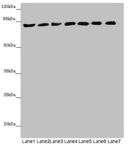 ACSL6 Antibody