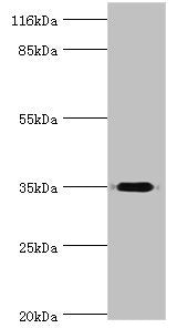 DIMT1 Antibody