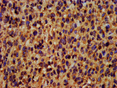 TRIM35 Antibody