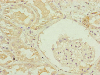 MID2 Antibody
