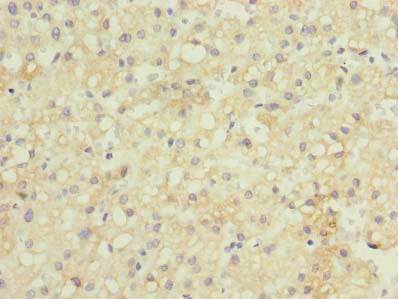GDF2 Antibody