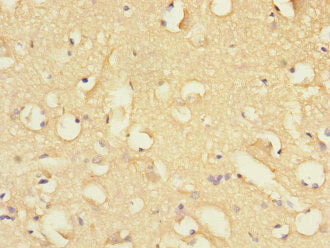 FBXO2 Antibody