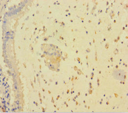 RARRES3 Antibody