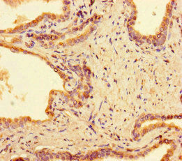 PPM1H Antibody