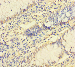 RPL26L1 Antibody