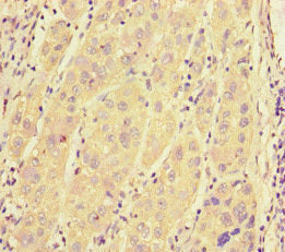 SRRM2 Antibody