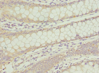 ANAPC2 Antibody