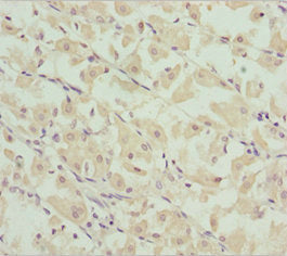CHIC2 Antibody