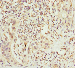 CHIC2 Antibody