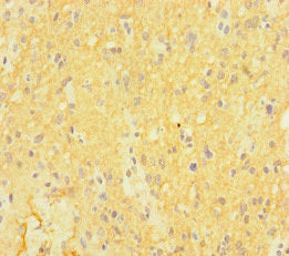 CTNND2 Antibody