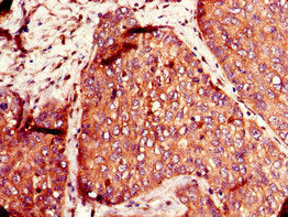 SLC12A7 Antibody