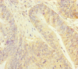 GINS2 Antibody