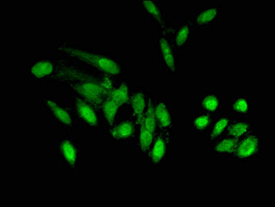 POLDIP2 Antibody