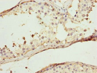 WIPI2 Antibody