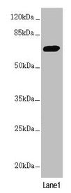 PPP2R3B Antibody